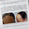 皮肤病临床精要 商品缩略图4