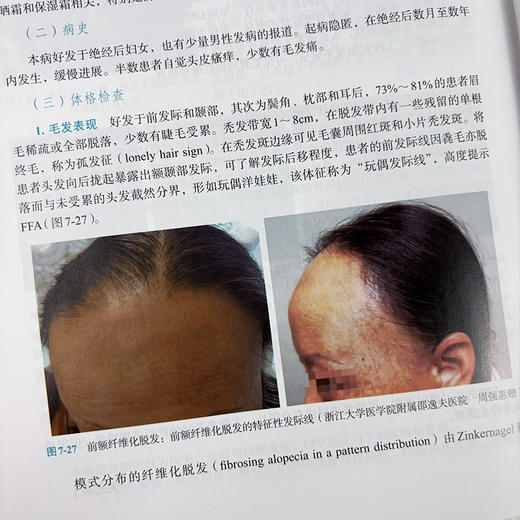 皮肤病临床精要 商品图4