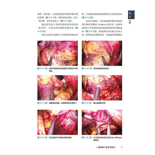 腹腔镜下外科手术精要 通过视频学习手术技术 [日]宫泽 光男 主编 王利明 李东 张春东 主译 9787559143716辽宁科学技术出版社 商品图3