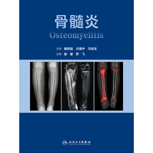 【预售】骨髓炎 商品图1