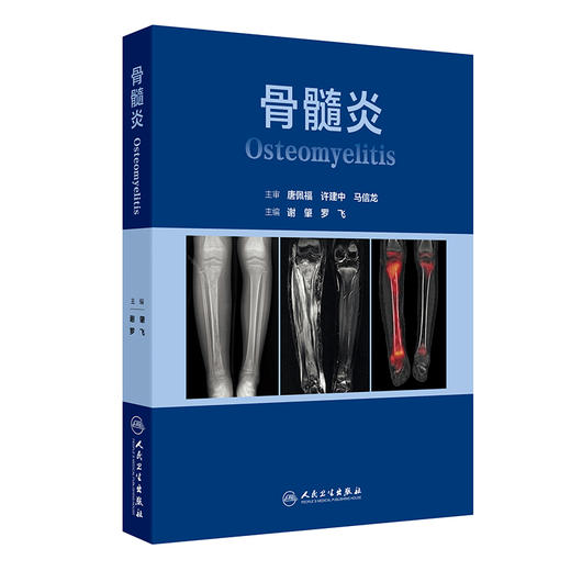 【预售】骨髓炎 商品图0