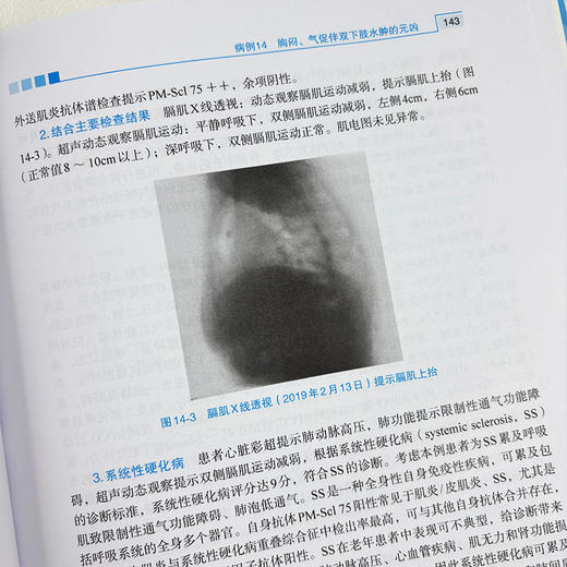 大内科疑难病例精选 9787030840165 商品图4