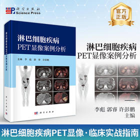 淋巴细胞疾病PET显像案例分析 9787030850201 李彪 郭睿 许彭鹏