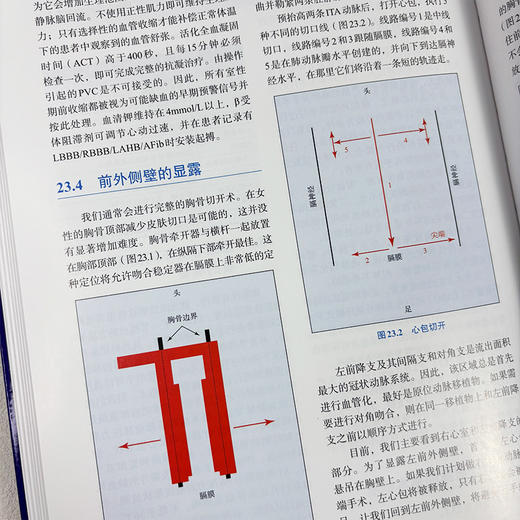 缺血性心脏病诊断与治疗 商品图4