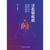 泛血管疾病抗栓治疗病例解析 商品缩略图1