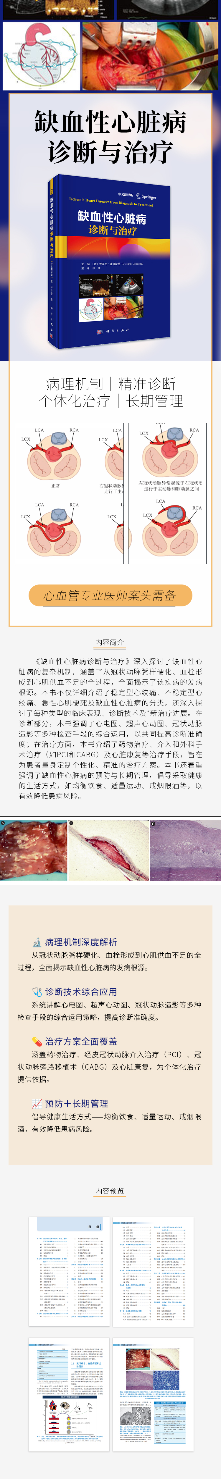 缺血性心脏病诊断与治疗xq.jpg