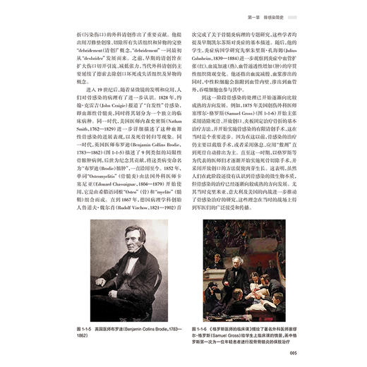 骨髓炎 谢肇 罗飞 主编 本书从基本理论（基础篇） 基本技术（技术篇） 临床应用（各论篇）三大部分依次展开叙述 人民卫生出版社 商品图4