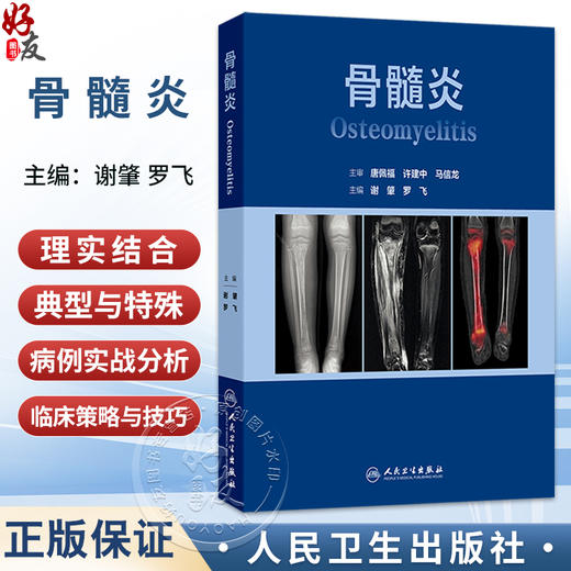 骨髓炎 谢肇 罗飞 主编 本书从基本理论（基础篇） 基本技术（技术篇） 临床应用（各论篇）三大部分依次展开叙述 人民卫生出版社 商品图0