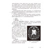 神经病学 第5五版 肖波 主编 十四规划新形态教材全国高等学校教材 供临床预防口腔影像专业高等学历继续教育等使用人民卫生出版社 商品缩略图4