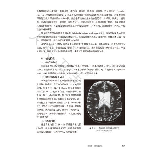 神经病学 第5五版 肖波 主编 十四规划新形态教材全国高等学校教材 供临床预防口腔影像专业高等学历继续教育等使用人民卫生出版社 商品图4