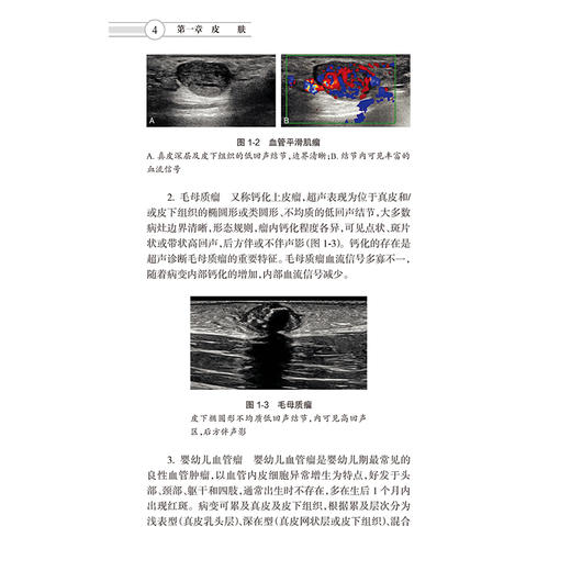 中国浅表器官超声检查指南 第2二版 中国医师协会超声医师分会 编著 中国医师协会超声医师分会指南从书 放射医学 人民卫生出版社 商品图4