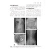 肿瘤姑息与支持治疗学理论与实践 第5五版 沈赞 揭示肿瘤姑息治疗的最佳路径 肿瘤姑息与支持治疗的一站式资源北京大学医学出版社 商品缩略图4