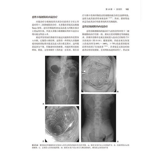 肿瘤姑息与支持治疗学理论与实践 第5五版 沈赞 揭示肿瘤姑息治疗的最佳路径 肿瘤姑息与支持治疗的一站式资源北京大学医学出版社 商品图4