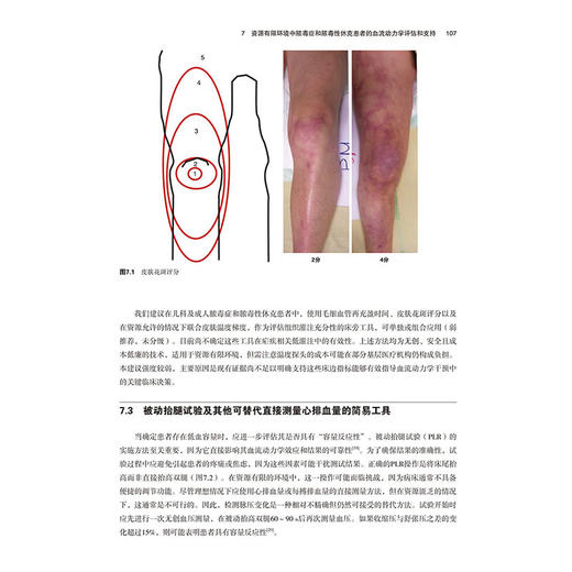 脓毒症管理策略 [英]巴勃罗.肯尼迪 主编 沈锋 刘颖 唐艳 刘旭 主译 在资源有限环境中识别脓毒症9787559145178辽宁科学技术出版社 商品图3