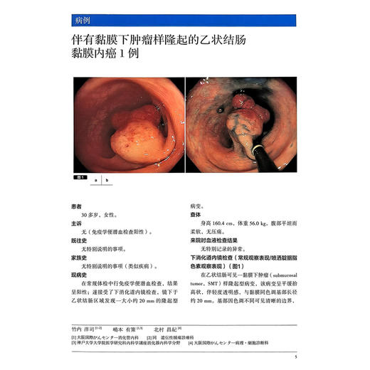胃与肠熟练掌握图像增强内镜（IEE）技术 胃与肠 日本胃与肠编委会 编著 胃与肠翻译委员会 译 9787559142979辽宁科学技术出版社 商品图3