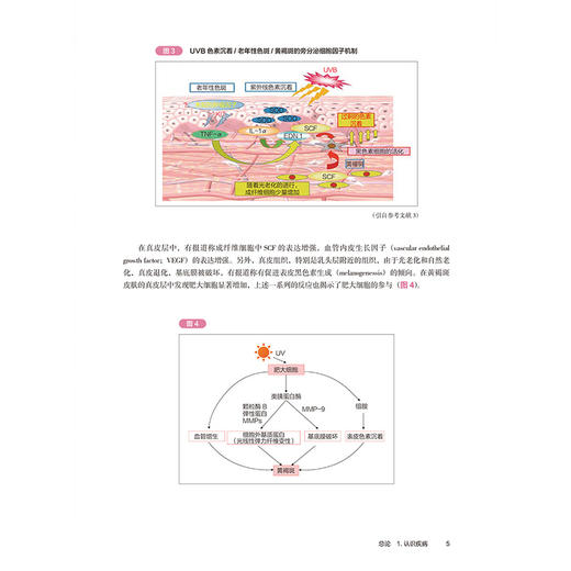 皮肤激光美容 色斑个性化治疗（日）黄圣琥 色斑治疗方案个性化治疗病例分析 皮肤科医生用书 9787559144706辽宁科学技术出版社 商品图4