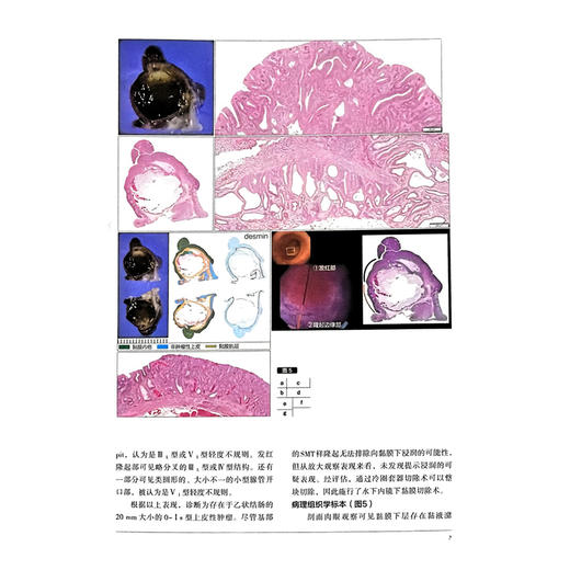胃与肠熟练掌握图像增强内镜（IEE）技术 胃与肠 日本胃与肠编委会 编著 胃与肠翻译委员会 译 9787559142979辽宁科学技术出版社 商品图4