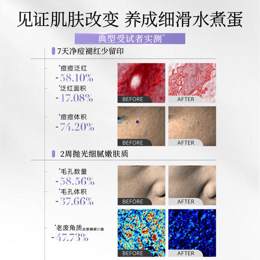 【酶C接力】酶酸凝抛光净痘嫩肤小杯冻膜6g*10+VC大桔面膜2盒 商品图3