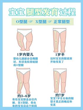 O型腿？X型腿？宝宝的腿不直，需要干预吗？