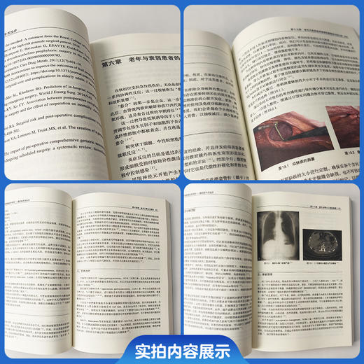 老年与衰弱患者急诊外科学 腹腔镜手术治疗 王维斌 蔺晨 主译 核心理念创新 诊疗体系完整 9787567928626 中国协和医科大学出版社 商品图2