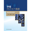 肿瘤PET/CT图谱——腹盆部肿瘤卷 商品缩略图1