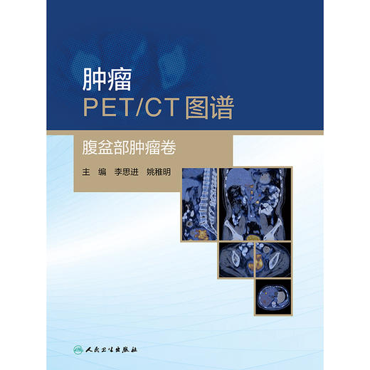 肿瘤PET/CT图谱——腹盆部肿瘤卷 商品图1