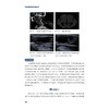 血管超声病例精粹与解析/贲志飞/浙江大学出版社 商品缩略图2