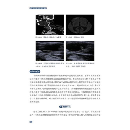 血管超声病例精粹与解析/贲志飞/浙江大学出版社 商品图2