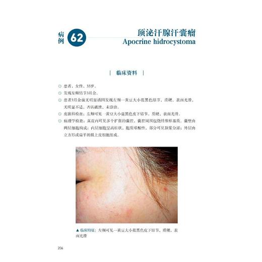 皮肤病病例精粹——从临床到病理（第3辑） 商品图3