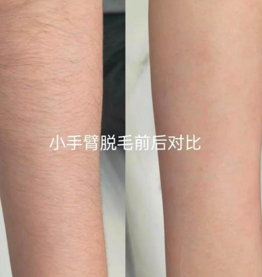 赠搓澡巾 脱毛器  纳米软磨设计 可脱毛去角质  A-6096 商品图4