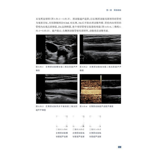 血管超声病例精粹与解析/贲志飞/浙江大学出版社 商品图3