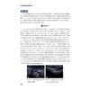 血管超声病例精粹与解析/贲志飞/浙江大学出版社 商品缩略图4