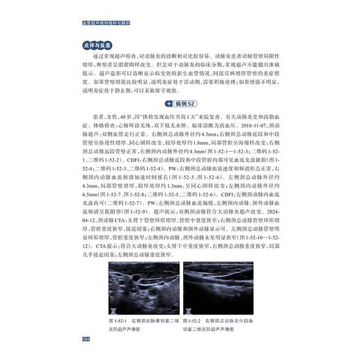 血管超声病例精粹与解析/贲志飞/浙江大学出版社 商品图4