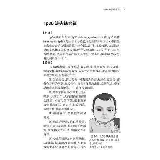 罕见病综合征速查 逯军 主编 内容介绍罕见病综合征的概念 发病情况 病因 诊断及治疗 并适当匹配临床图片说明 人民卫生出版社 商品图4