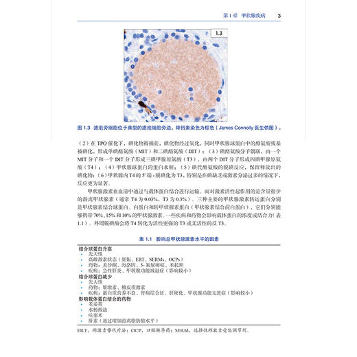 临床内分泌疾病和代谢病图谱 美 波林·卡马乔 主编 全面论述了包括糖尿病技术在内的最新疗法 9787559146380 辽宁科学技术出版社 商品图4