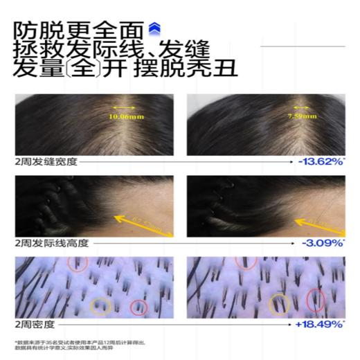 【6边形防脱战士 倍量密发更控油】EHD国货防脱固发洗发水400ml/瓶（国妆特字20241933、专利号ZL202410139042.7） 商品图1