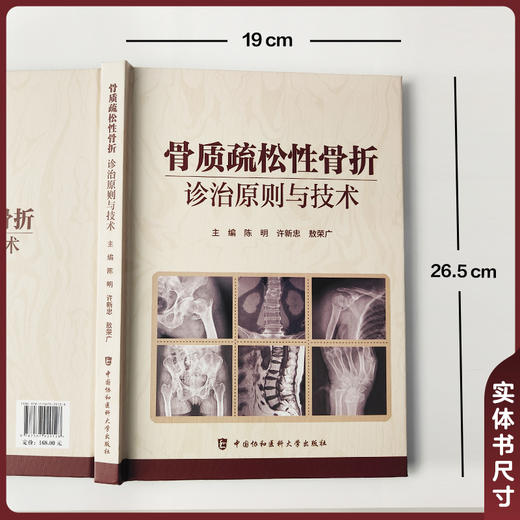 骨质疏松性骨折诊治原则与技术 陈明 许新忠 敖荣广 主编 对标全新指南 打破学科壁垒 9787567929128 中国协和医科大学出版社 商品图4