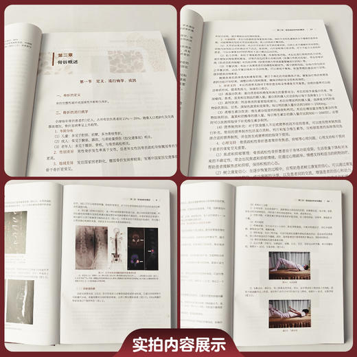 骨质疏松性骨折诊治原则与技术 陈明 许新忠 敖荣广 主编 对标全新指南 打破学科壁垒 9787567929128 中国协和医科大学出版社 商品图2