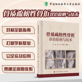 骨质疏松性骨折诊治原则与技术 陈明 许新忠 敖荣广 主编 对标全新指南 打破学科壁垒 9787567929128 中国协和医科大学出版社