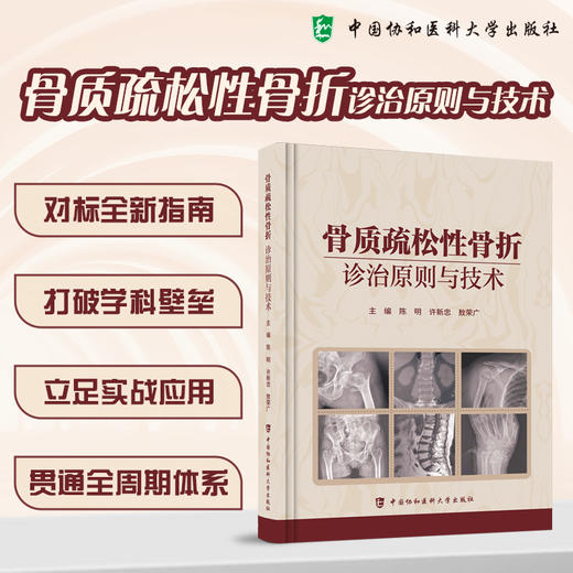 骨质疏松性骨折诊治原则与技术 陈明 许新忠 敖荣广 主编 对标全新指南 打破学科壁垒 9787567929128 中国协和医科大学出版社 商品图0