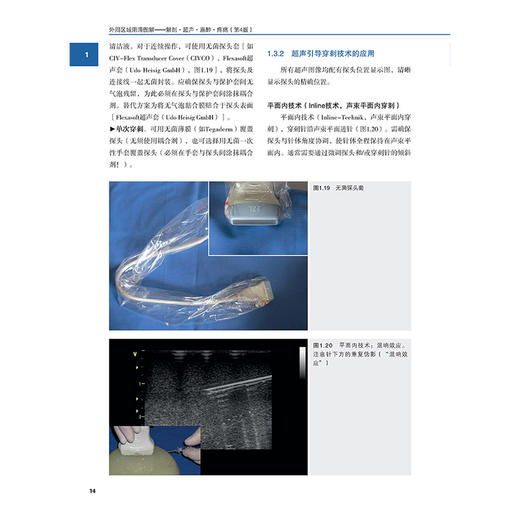 外周区域阻滞图解 解剖 超声 麻醉 疼痛 第4四版 德 吉塞拉 梅尔 等主编 王云 马丹旭 郭瑞娟主译9787559146403辽宁科学技术出版社 商品图4
