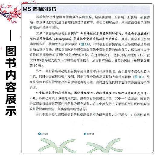 胆胰内镜的基础及技巧 谢威 李婧 祝建红 主译 对ERCP/EUS的基础操作与进阶手法进行了精细讲解等9787559136640辽宁科学技术出版社 商品图4