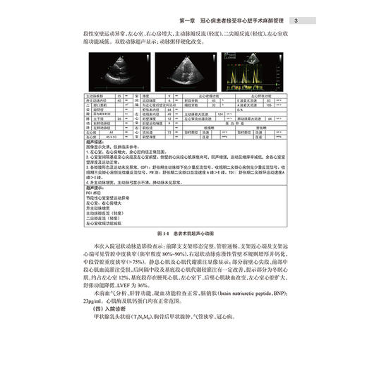 伴发心血管疾病患者围麻醉期处理 精选案例解析第2二版 赵丽云 涵盖合并的心脏病种类有合并冠心病等施行非心脏手术人民卫生出版社 商品图4