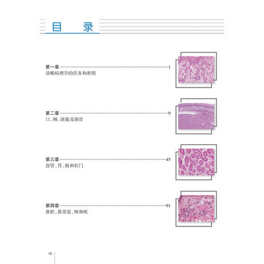 刘彤华诊断病理学 第5五版 梁智勇 陈杰 丁华野 主编 涵盖病理学诊断总则及人体各器官系统疾病的病理诊断知识 人民卫生出版社 商品图3