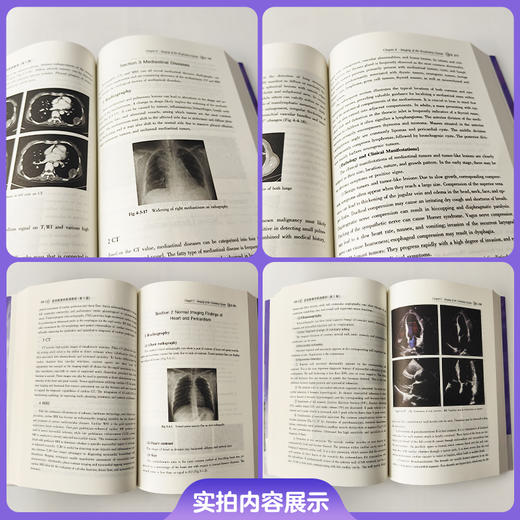 医学影像学英语教程 第2版 张冰 牡丹 赵一平 主编 内容迭代升级 编写适配教学 适用人群广泛9787567929142中国协和医科大学出版社 商品图2