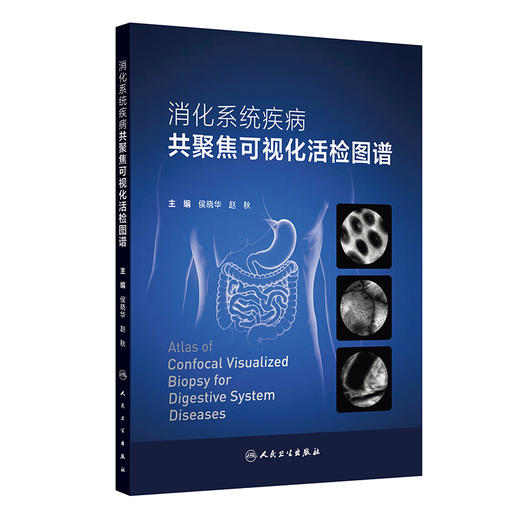 消化系统疾病共聚焦可视化活检图谱 商品图0