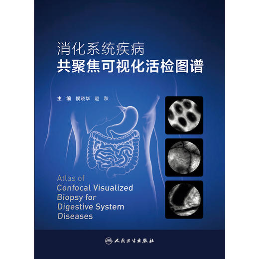 消化系统疾病共聚焦可视化活检图谱 商品图1