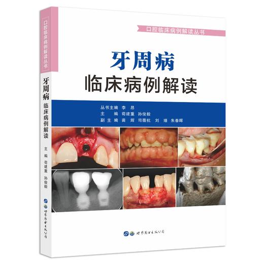 牙周病临床病例解读  主编  苟建重  孙俊毅  世界图书出版 商品图0