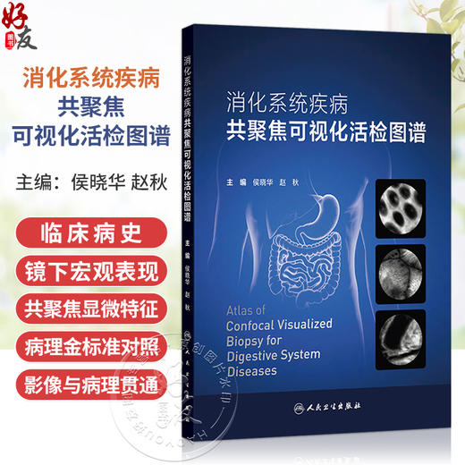 消化系统疾病共聚焦可视化活检图谱 侯晓华 赵秋 主编 详细介绍共聚焦显微内镜的起源和发展史 9787117397070 人民卫生出版社 商品图0