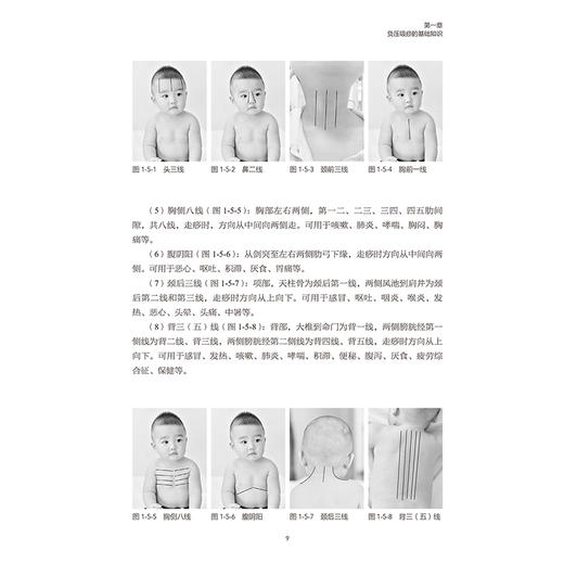 小儿负压吸痧 王立新 马颖桃 王宇峰 主编 适用于儿科患者 具有基本无痛苦 疗效显著的特点 9787117395212 人民卫生出版社 商品图4